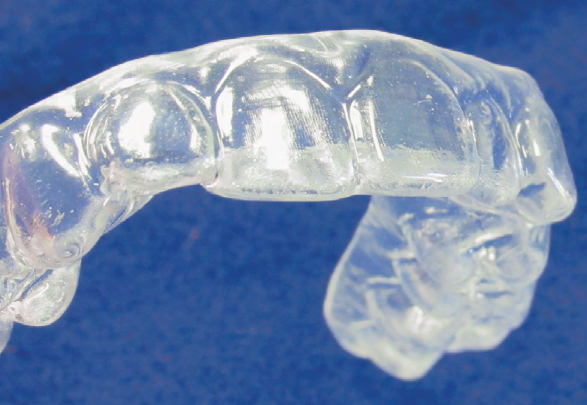 essix retainer